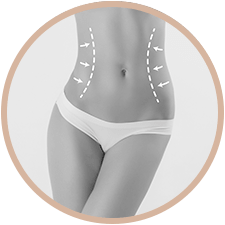 Lipoaspiration